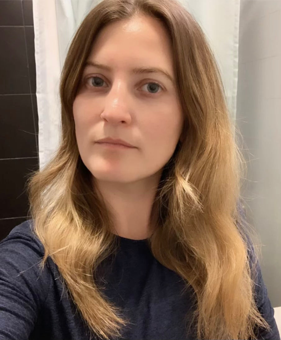 woman with frizzy hair before dimo silk scrunchies
